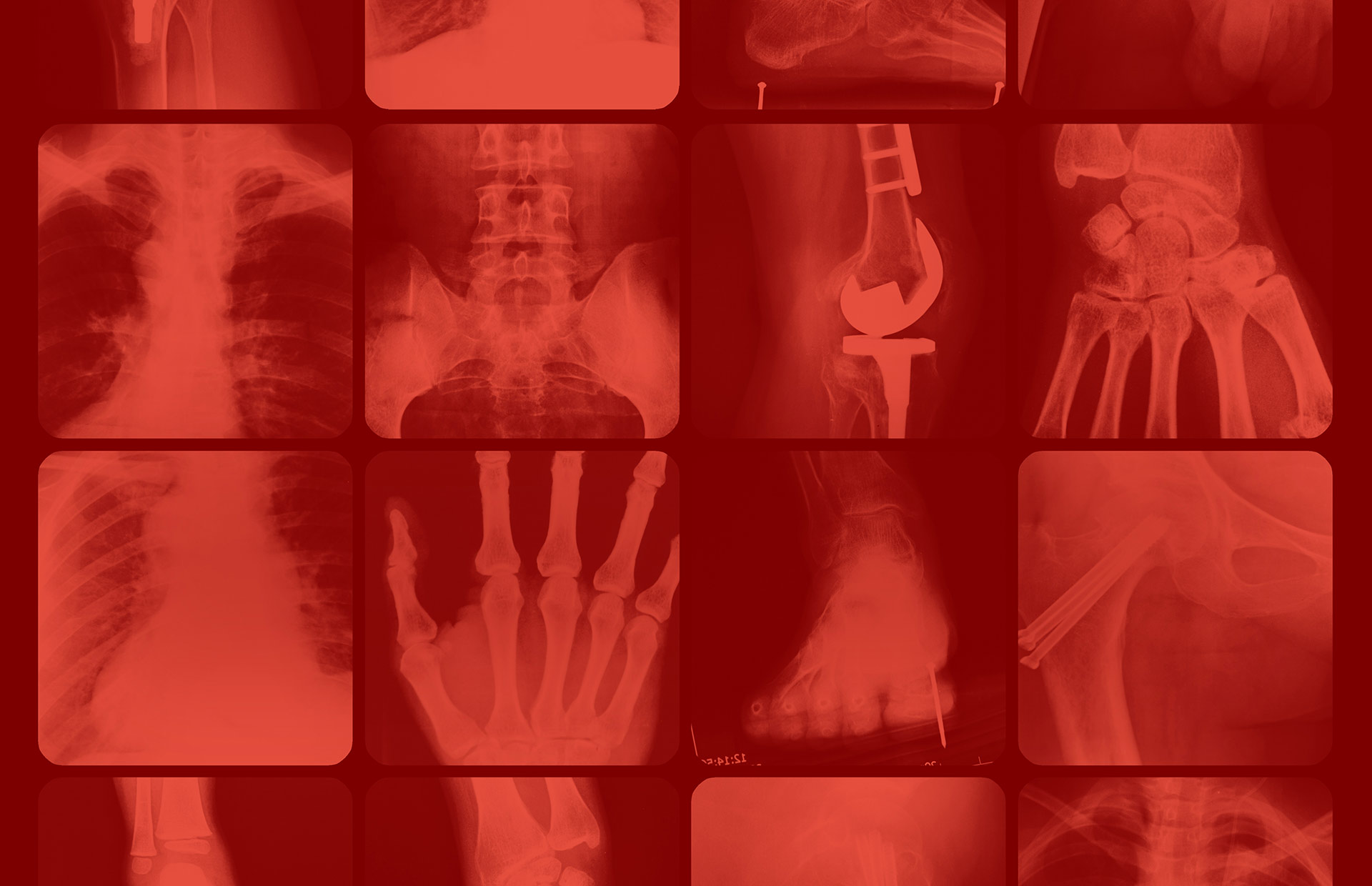 Artful graphic collage of several x-rays with a red overlay illustrating spine, hands, foot, hips, knees, and elbows repairs.