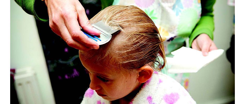 Head Lice