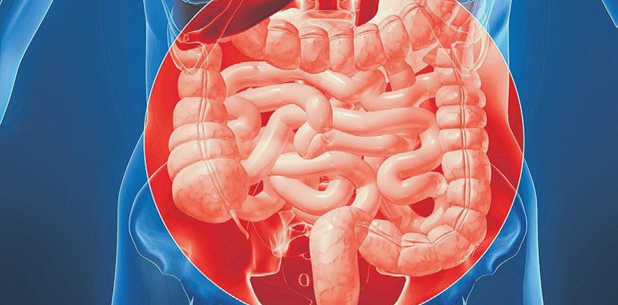 colon cancer