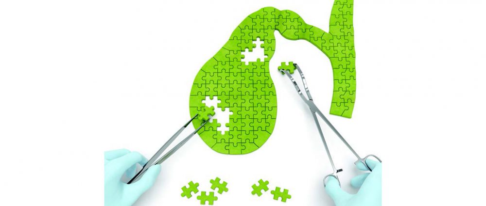 Gallbladder Seminar