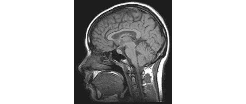 WAMC: Medical Monday – Psychiatry with Dr. Joseph Di Lullo